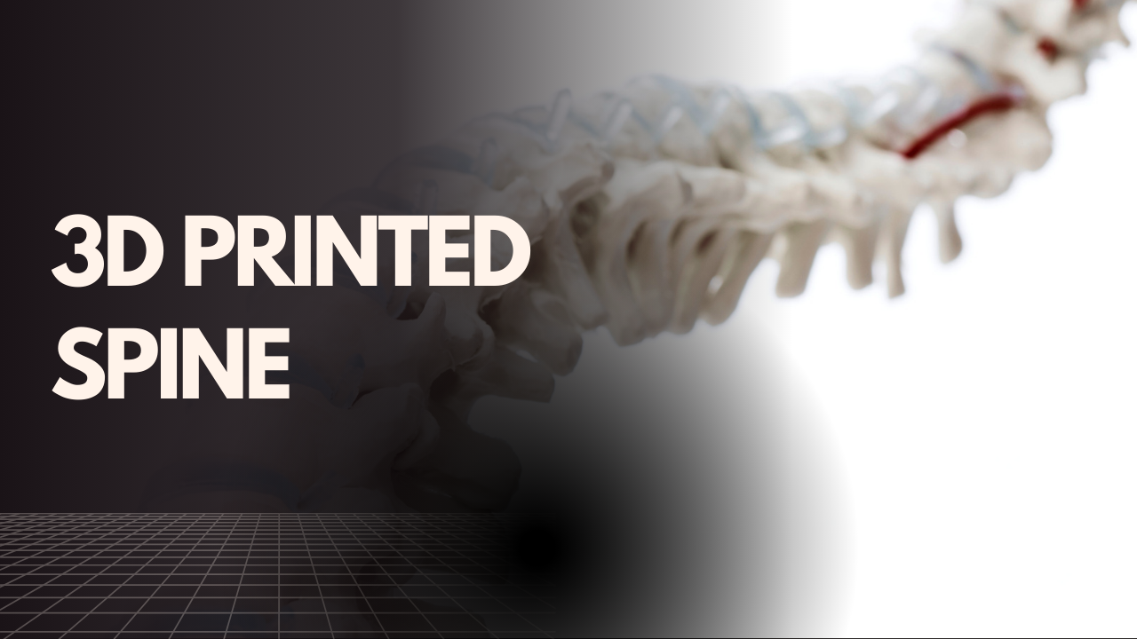 3D printed spine