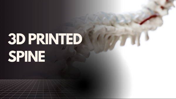 3D printed spine